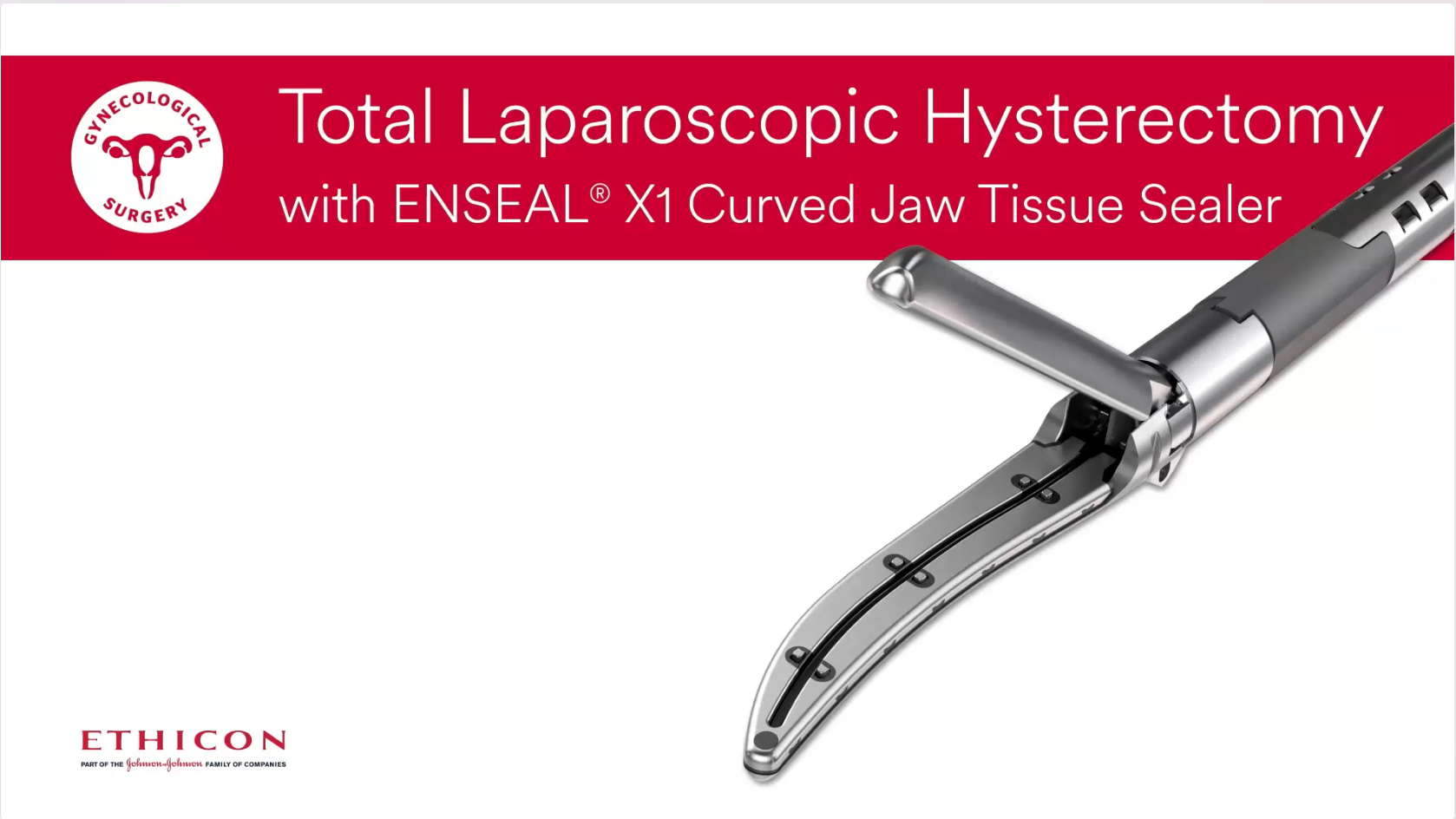 Enseal® X1 Curved Jaw Dr Thott TLH_BSO Video