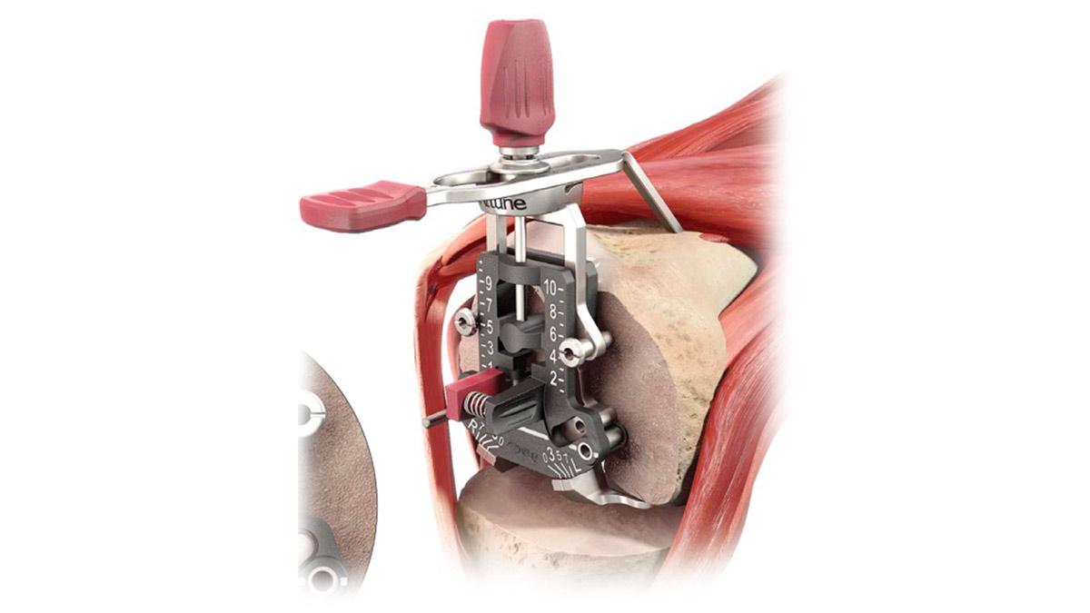 Sizing/rotation guide placed against resected surface of distal femur during total knee arthroplasty