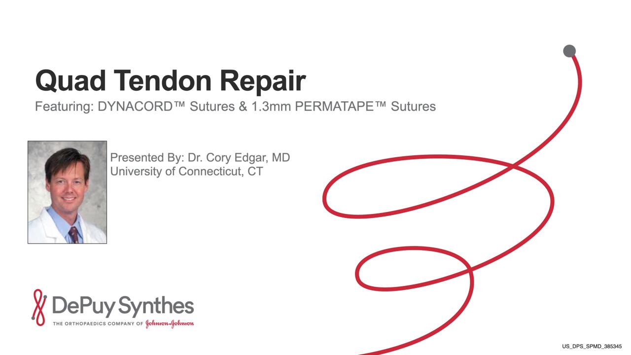 Quad Tendon Repair Using DYNACORD Sutures 1.3 and PERMATAPE Featuring Cory Edgar Video