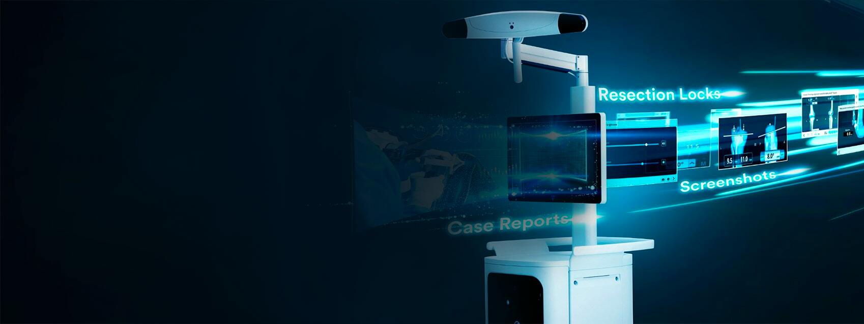VELYS Robotic-Assisted Solution Cadence of Innovation