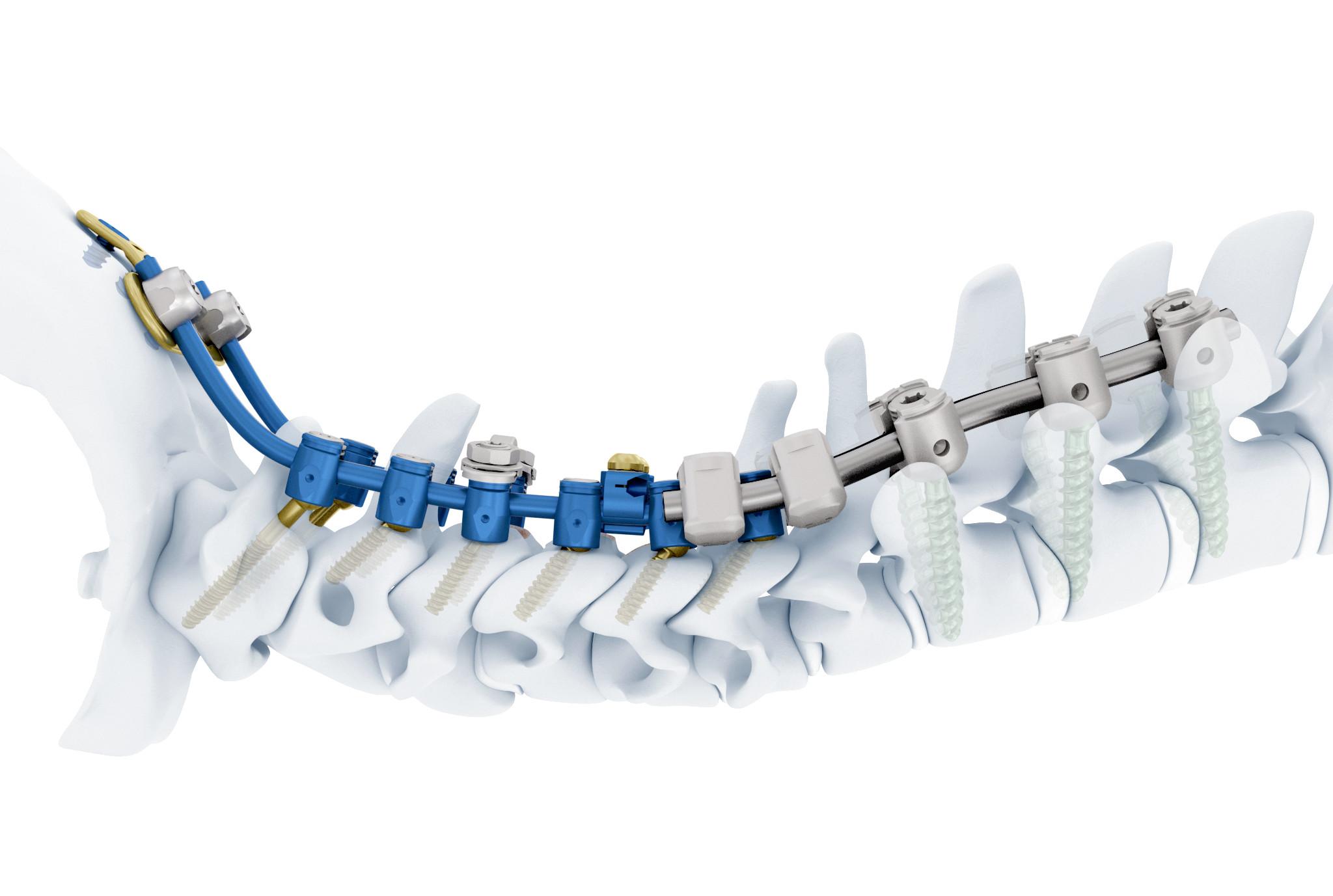 cervical spine system spine image