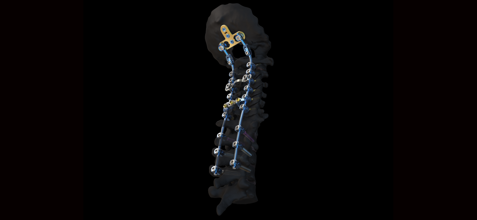 cervical spine system depuy synthes