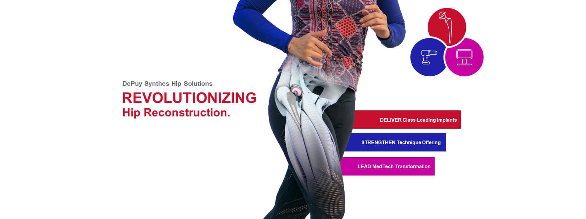 Revolutionizing Hip Reconstruction