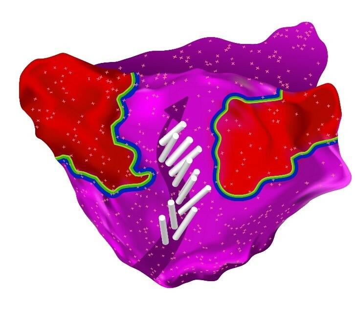 CONFIDENSE™ Module with Ripple Mapping 